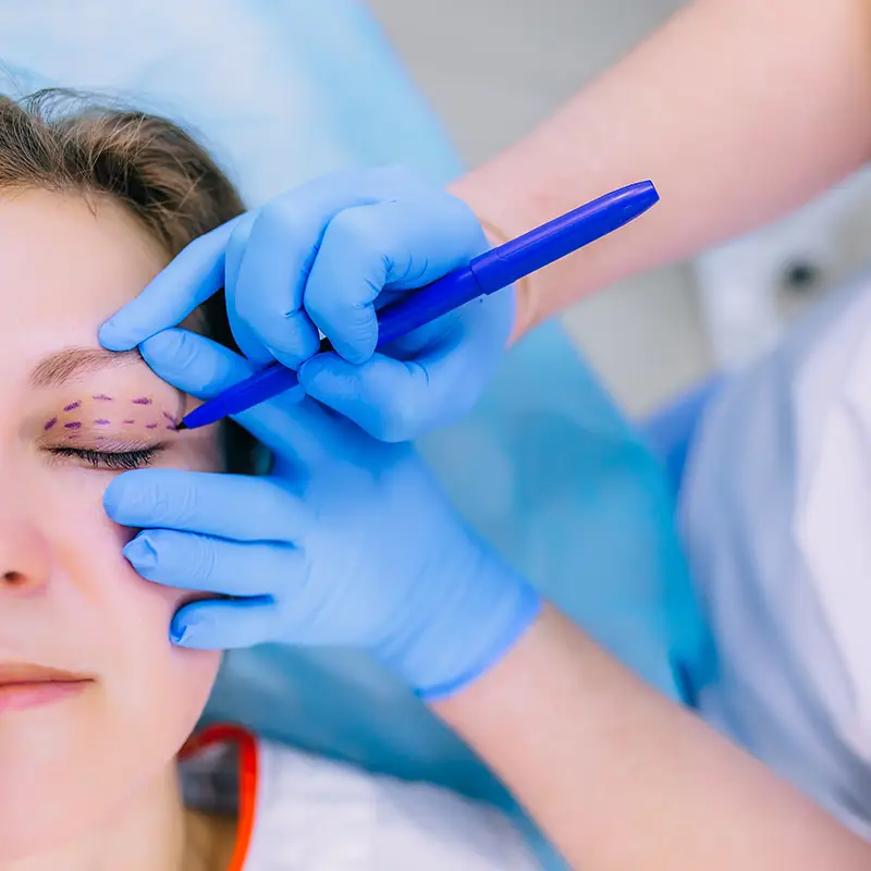 Blépharoplastie