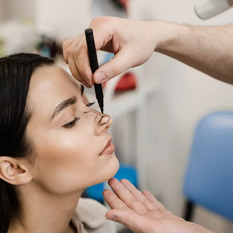 Rhinoplastie