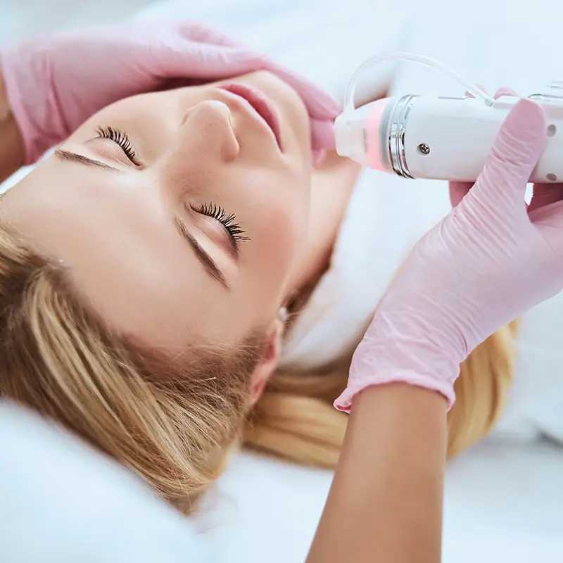 Microneedling