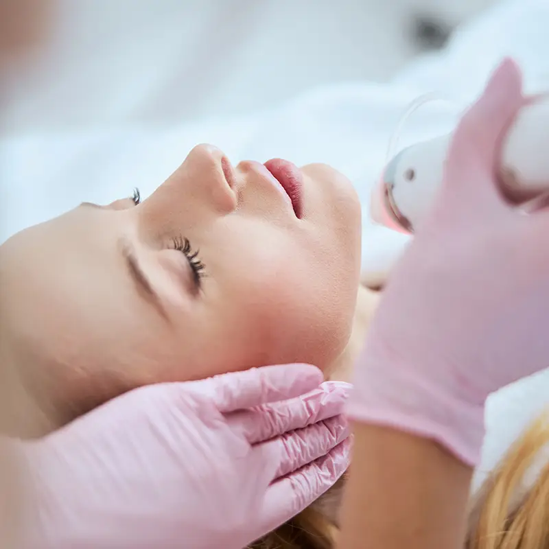 Microneedling (Derma Pen)